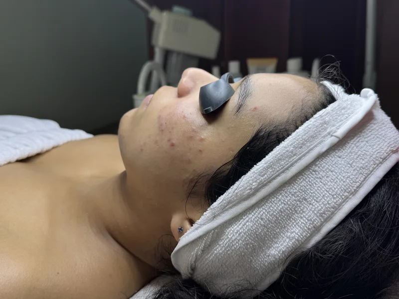 Antes del tratamiento