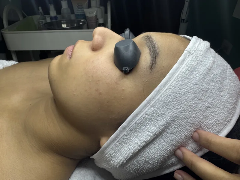 Después del tratamiento